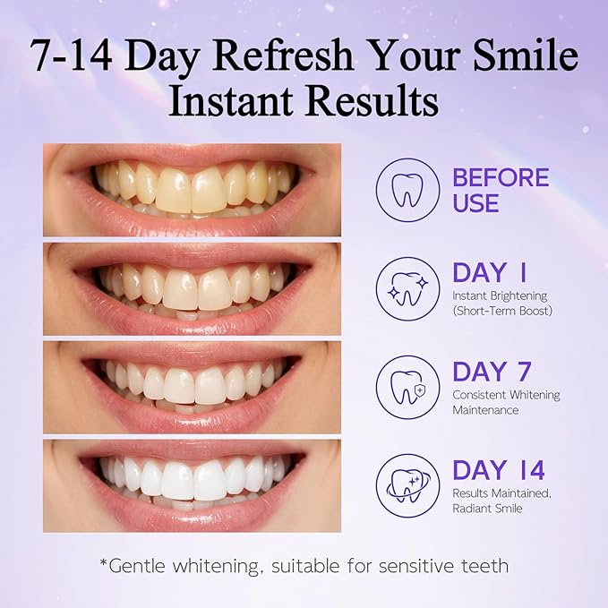 Purple Teeth Whitening Strips, Color Correcting White Kit, Peroxide-Free with Hydroxyapatite, Express & Professional Strips, Enamel Safe for Sensitive Teeth, Tooth Stain Remover (28 Strips)