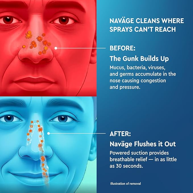 Navage® Multi-User Bundle - Navage Irrigation System - Saline Nasal Rinse Kit with 1 Nose Cleaner, 30 Salt Pods, and Extra Nasal Dock and Pair of Nose Pillows