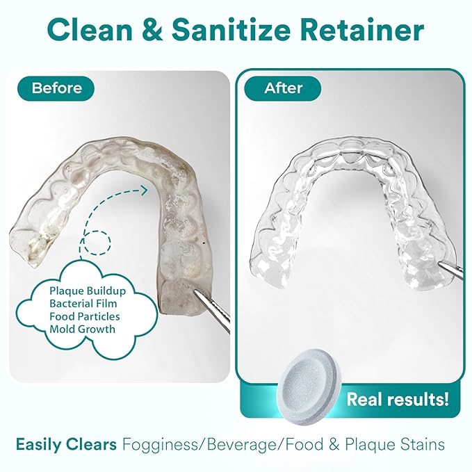 Weiss Naturals Retainer Cleaner Tablets, Invisalign Cleaner, Remove Stains, Odors & Plaque, PERSULFATE FREE Night Guard & Denture Cleaner 2-Month Supply, 60 Mint Scented Tablets